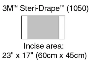 3M™ Steri-Drape™ Sterile Large Incise Surgical Drape, 17 x 23 Inch, 1 Case of 40