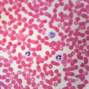 Human Blood Film Slide, Smear, H&E (USA)