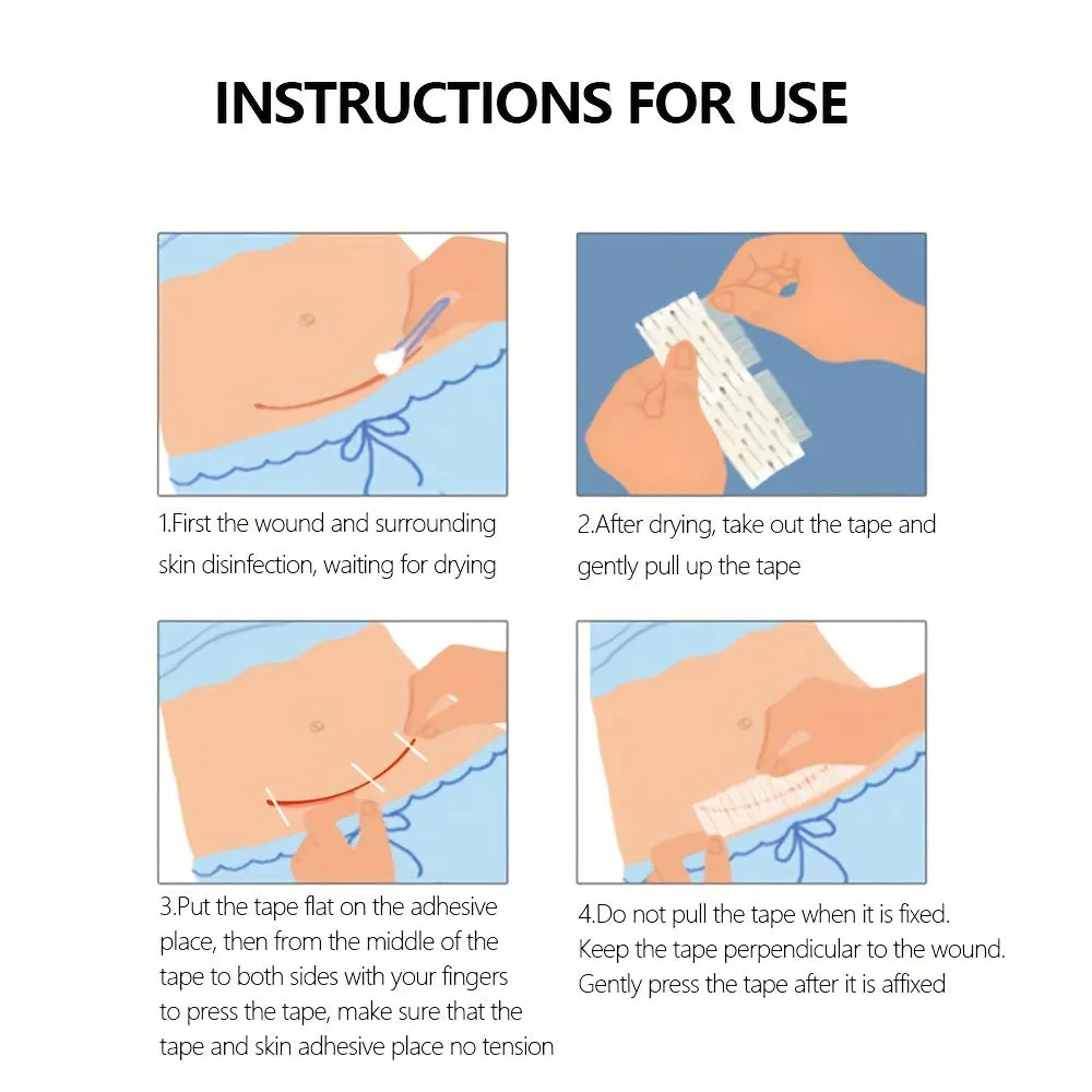 Skin Closure SelfAdhesive Tape Kit for Csections and Wounds